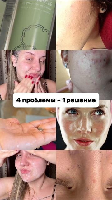 Гель Cosmeya WW152227 на WB — от черных точек и акне