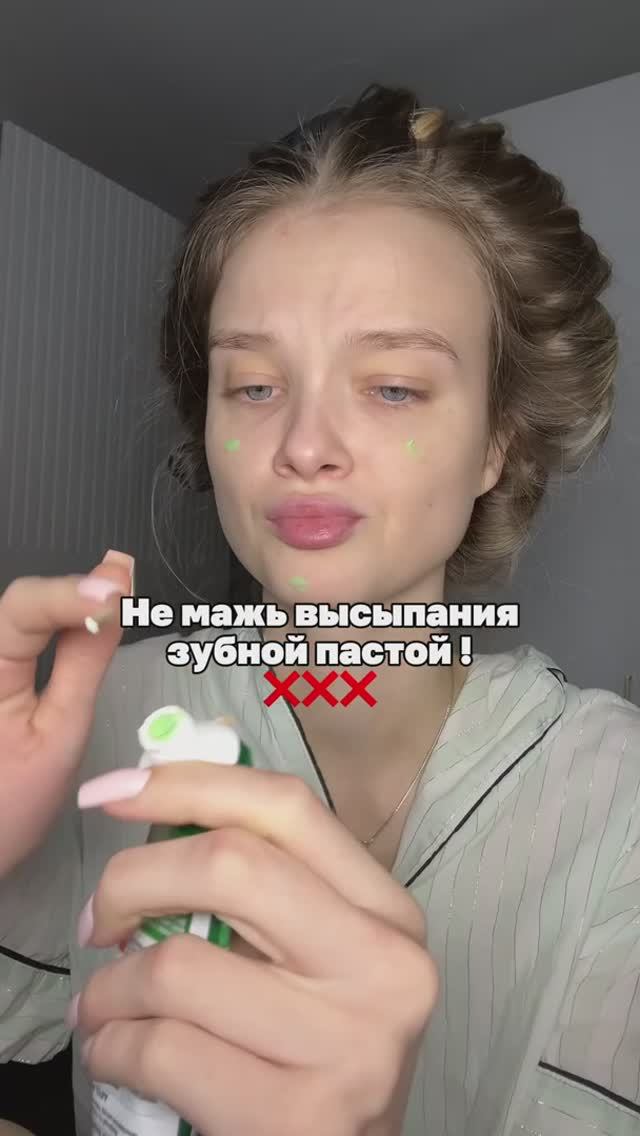 Как избавиться от прыщей?