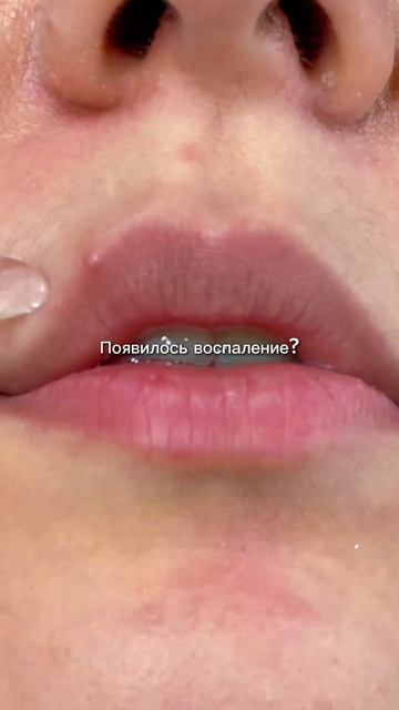 Пилинг от прыщей Cosmeya WW123351 (ВБ)#макияж#пилинг