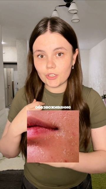 Пилинг❣️ от акне и воспалений Cosmeya на ВБ: WW150989 (копируй полностью) 

#проблемнаякожа #уход #у