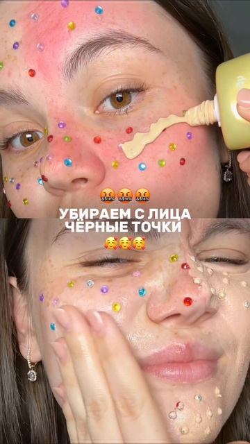 Второй способ лучше 🥹 Пилинг от акне Cosmeya на вб: WW150989❣️гель на вб: WW174564

#черныеточки #пр