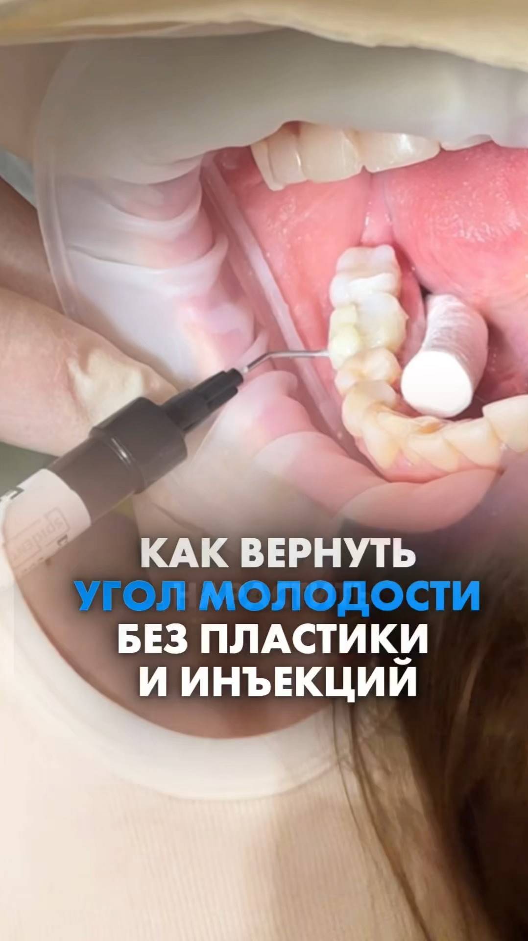 КАК ВЕРНУТЬ УГОЛ МОЛОДОСТИ БЕЗ ПЛАСТИКИ И ИНЪЕКЦИЙ. Татьяна Бондарева #подушкамиката #уголмолодости