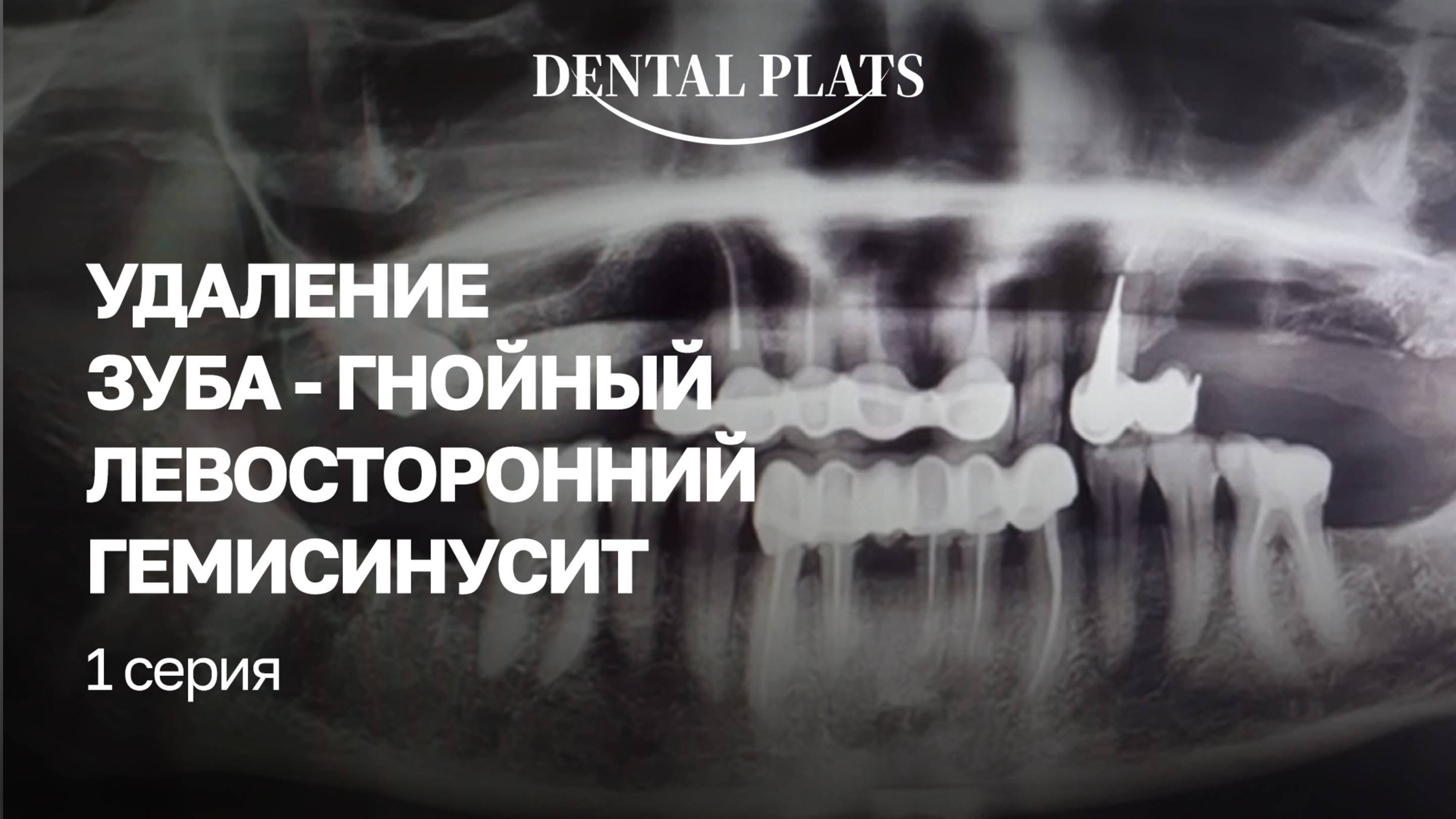 Диагноз поставлен. 1 серия сериала от Дентал Платс