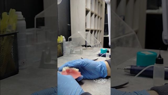 Вклеиваем искусственные зубы в съемный протез
