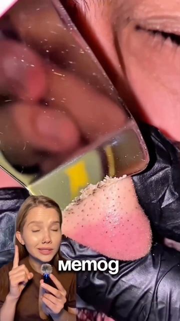 Оно отчистит поры ТАК👀пилинг от акне Cosmeya:WW150990 на ВБ