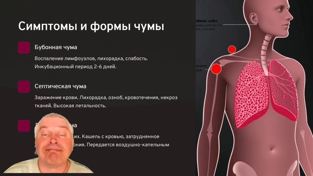 Что такое чума?