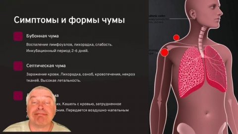 Что такое чума?