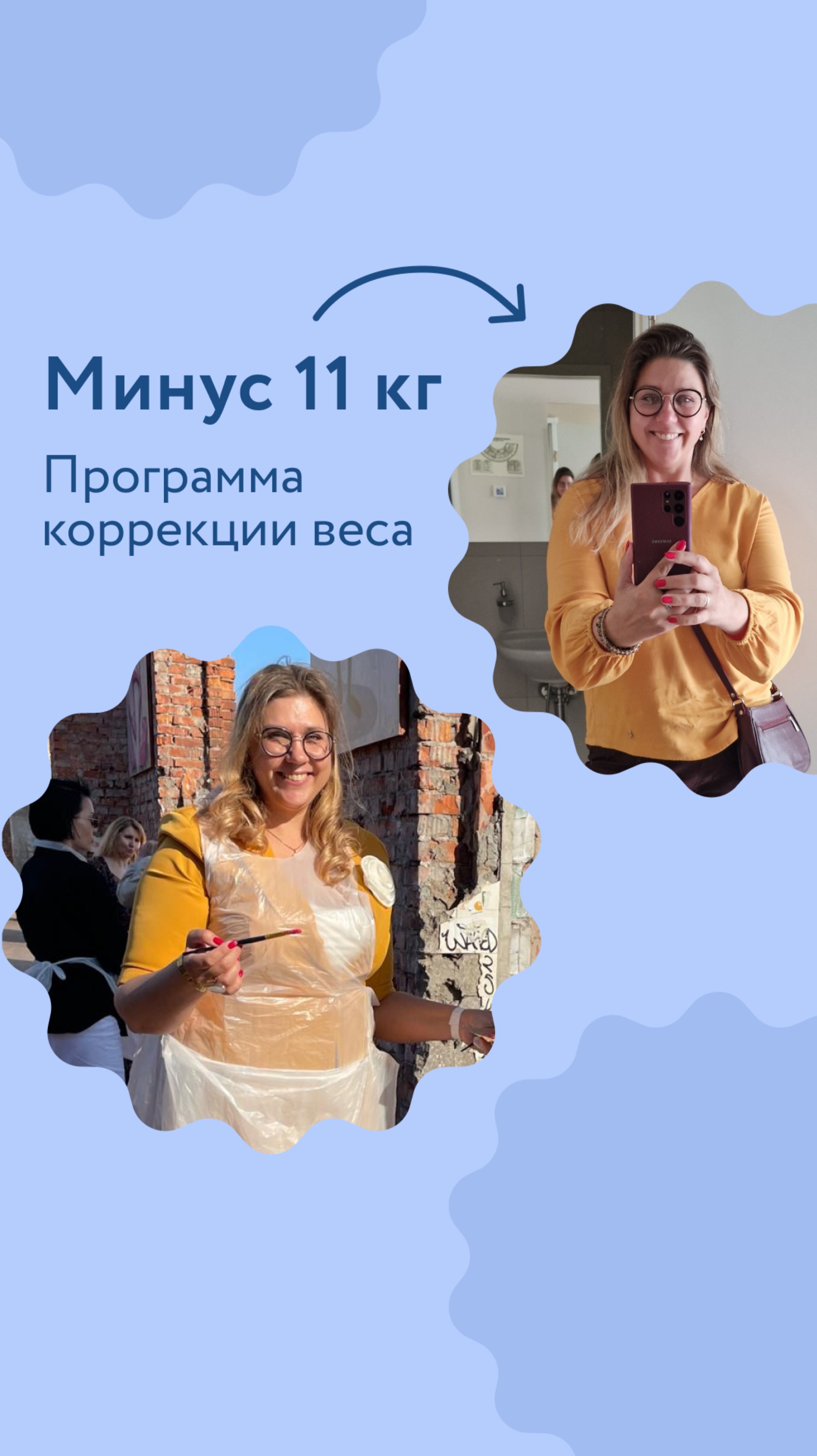 Минус 11 кг! Делимся результатами нашей пациентки.