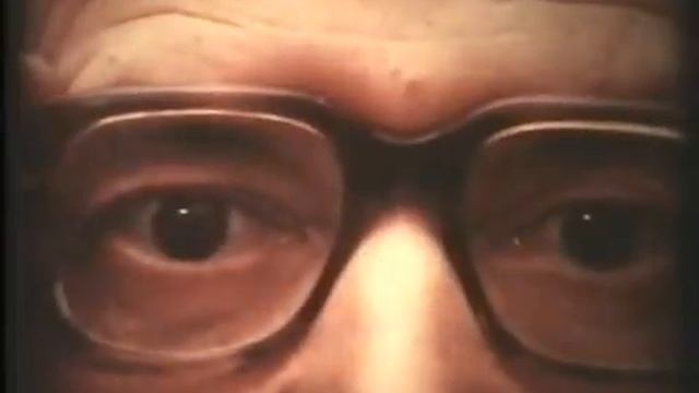 Косоглазие его виды бинокулярное зрение  Strabismus. Academician M.Krasnov 360p