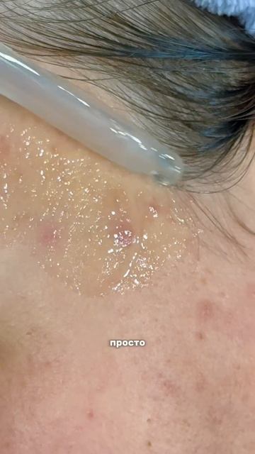 Пилинг от прыщей Cosmeya WW123351 (ВБ)#макияж#пилинг