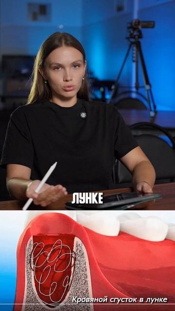 Одна из наиболее частых причин осложнений после удаления зуба  потеря кровяного сгустка 