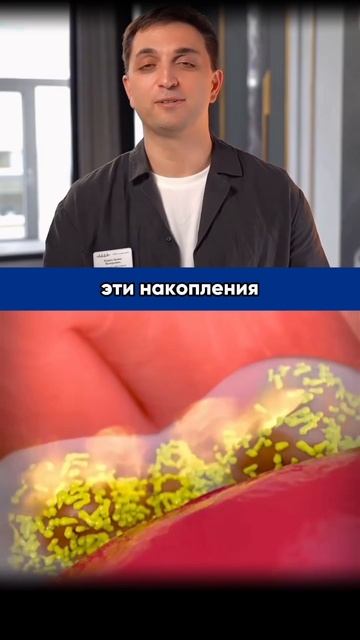 Комки во рту