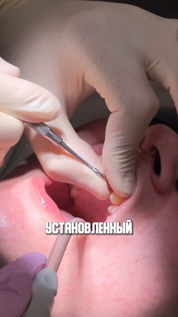 Что включает в себя диагностика перед ортодонтическим лечением?