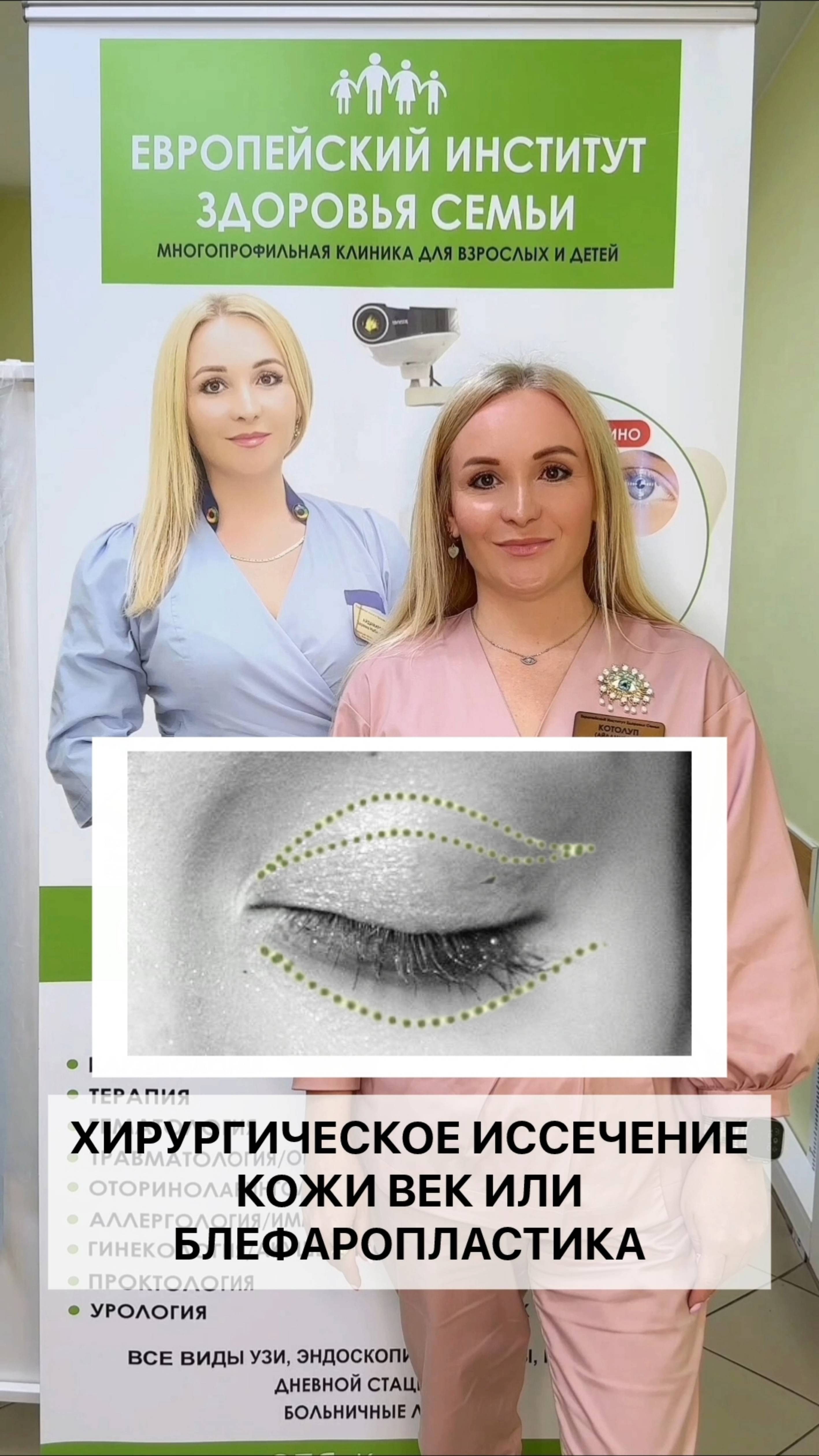 Хирургическое иссечение кожи век или боефаропластика. Рассказывает Котолуп Зарема Набирулаевна