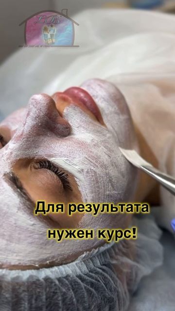 Химический пилинг