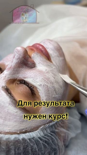 Химический пилинг может быть разным и очень важным в этапе твоего ухода .. химическипилинг biorepe