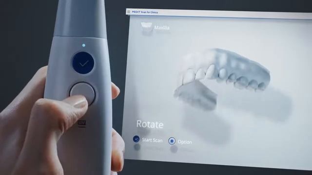 Medit i700: Знакомимся с интуитивным интраоральным сканером из Южной Кореи  Вилана Дент