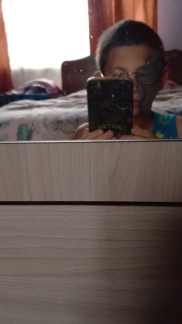 вирус 2 до и после