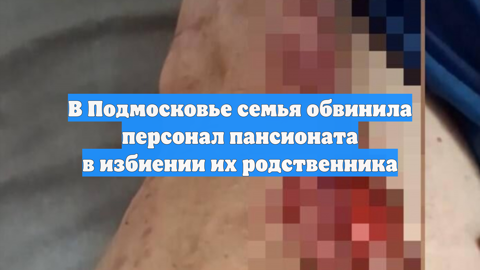 В Подмосковье семья обвинила персонал пансионата в избиении их родственника