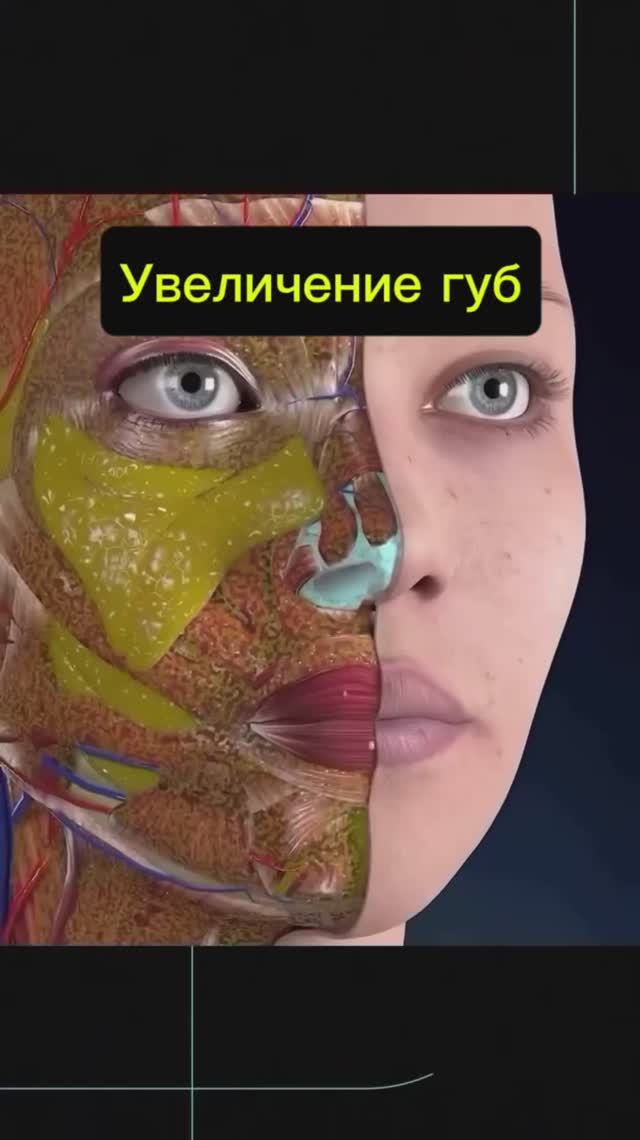 Увеличение губ через укол