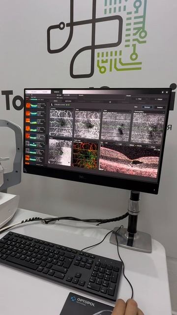 Оптический когерентный томограф - Optopol Revo 60 для точной послойной визуализации структур глаза