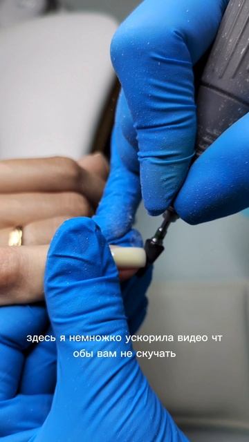 гипонихий
