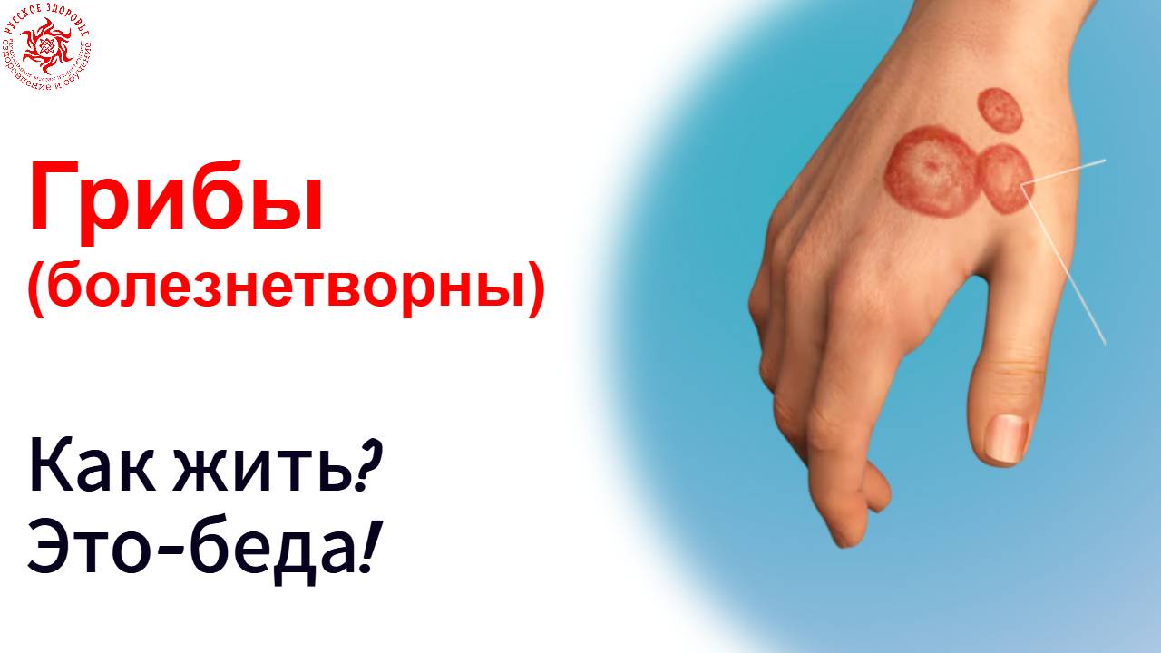 Грибы болезнетворные. Как жить. Часть 2