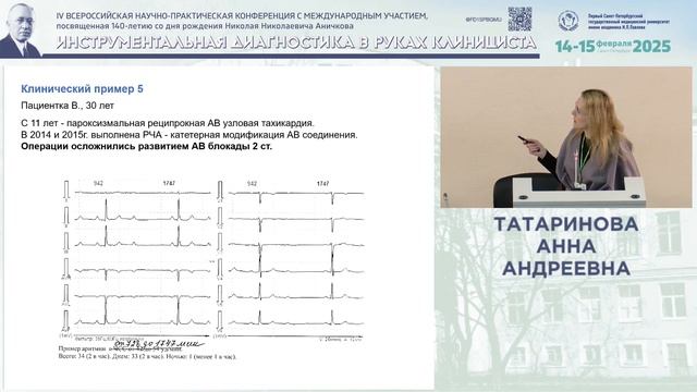 Ценность ЭКГ-нагрузочных проб при нарушениях сердечной проводимости