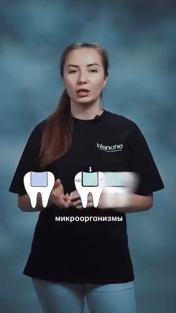 Почему со временем старые пломбы нужно менять?