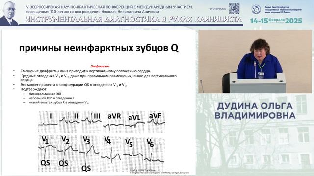 Зубец Q - ad gloriam