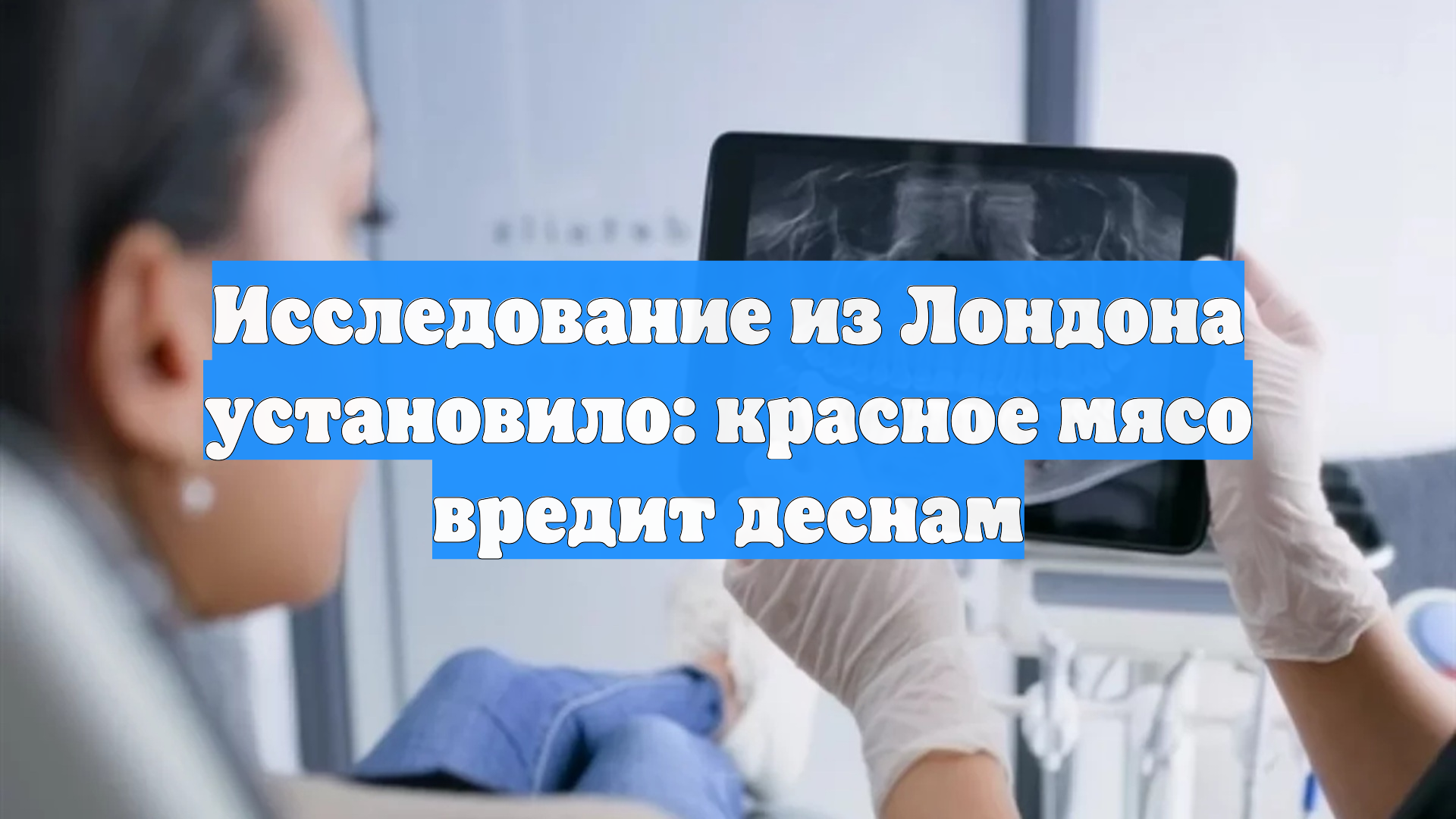 Исследование из Лондона установило: красное мясо вредит деснам