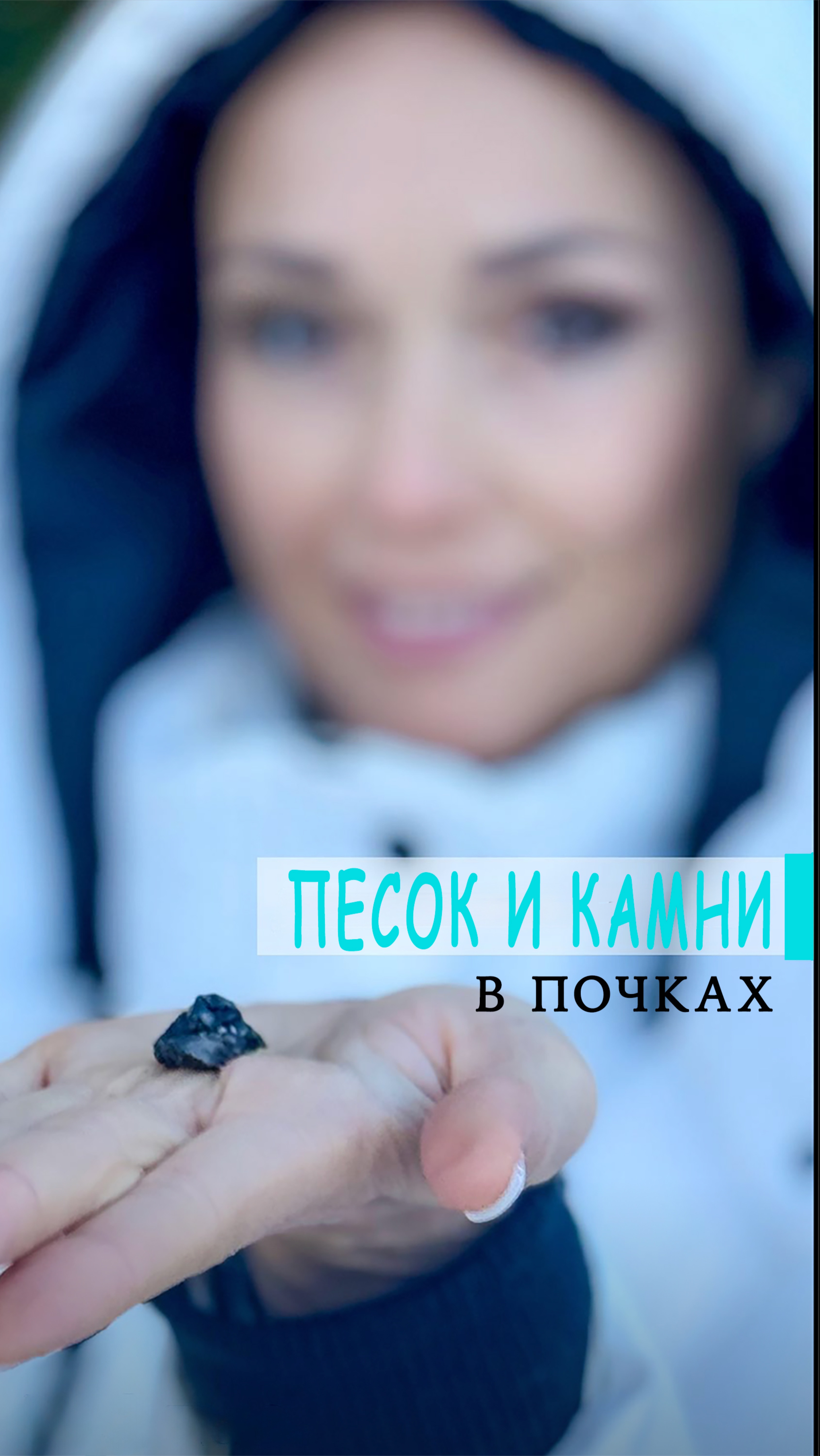 Формирование песка и камней в почках и желчном пузыре
