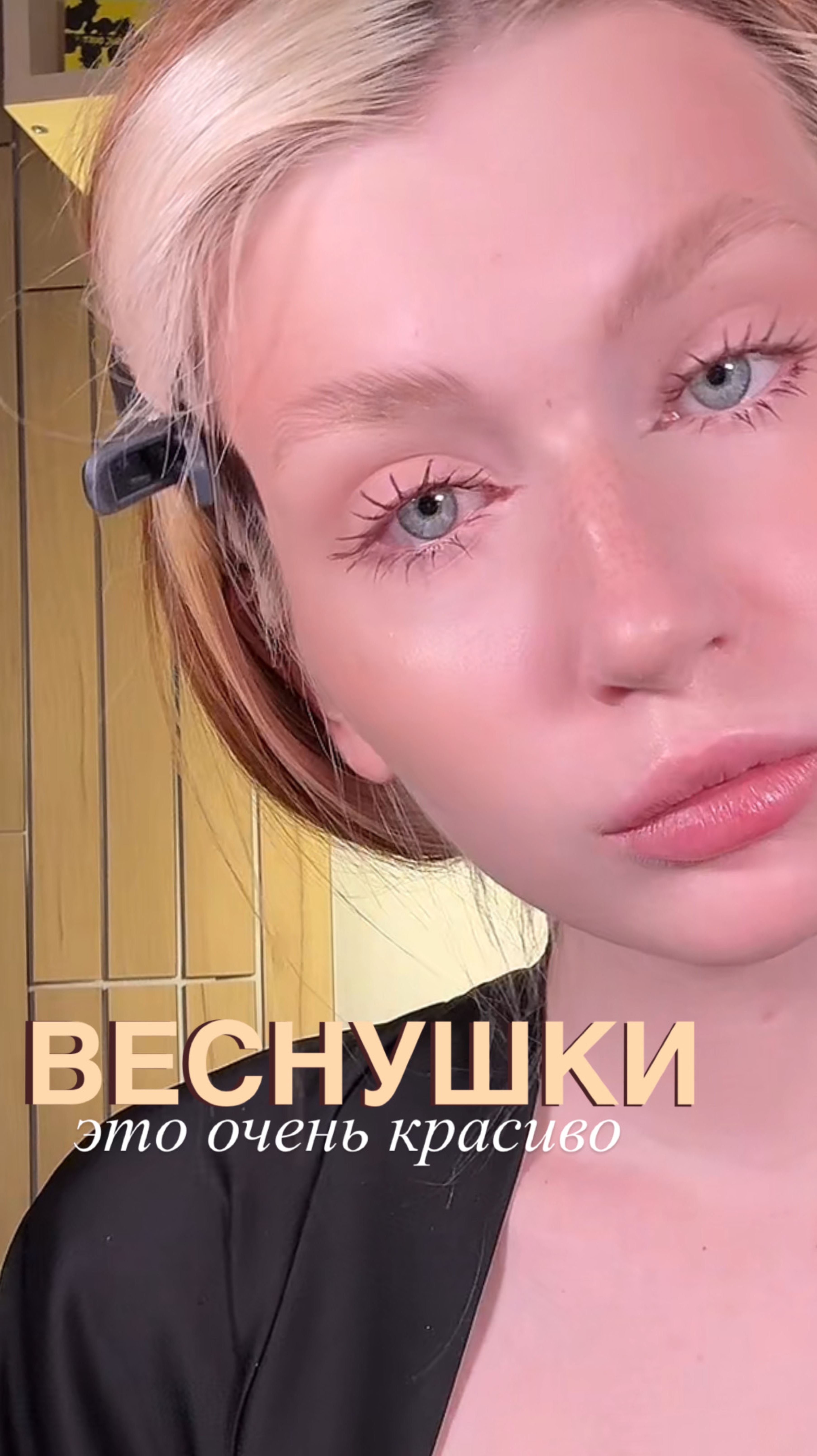 я просто обожаю веснушки