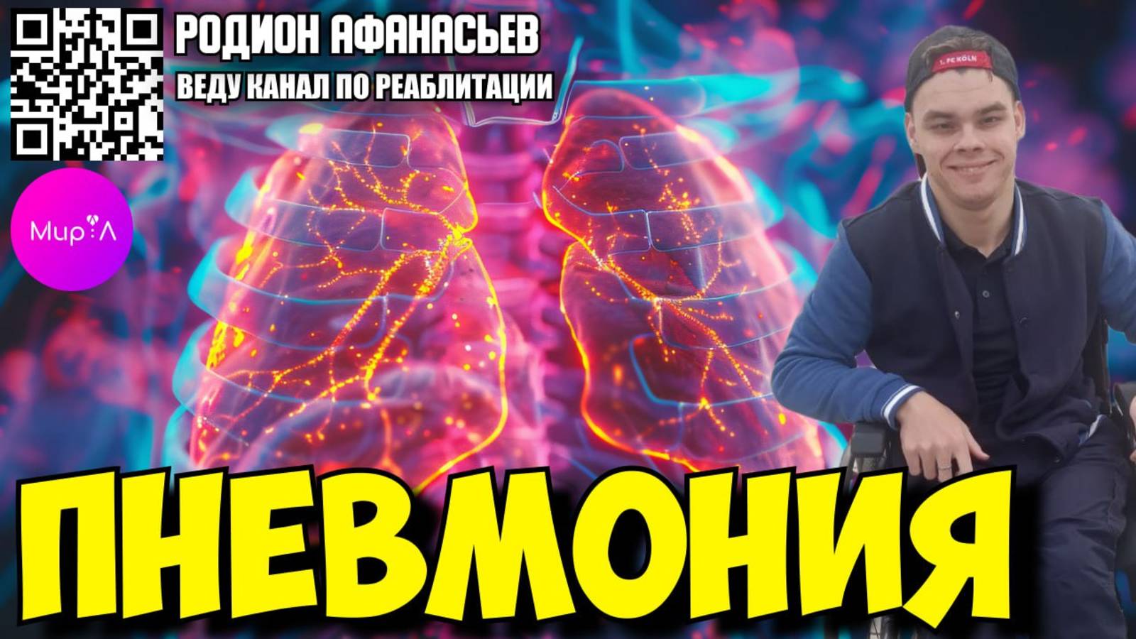 Родионов Афанасьев. ПНЕВМОНИЯ.