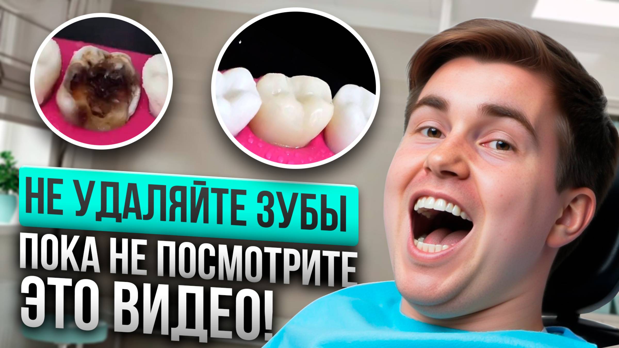 Не удаляйте зуб: 5 случаев, когда его можно спасти без имплантата