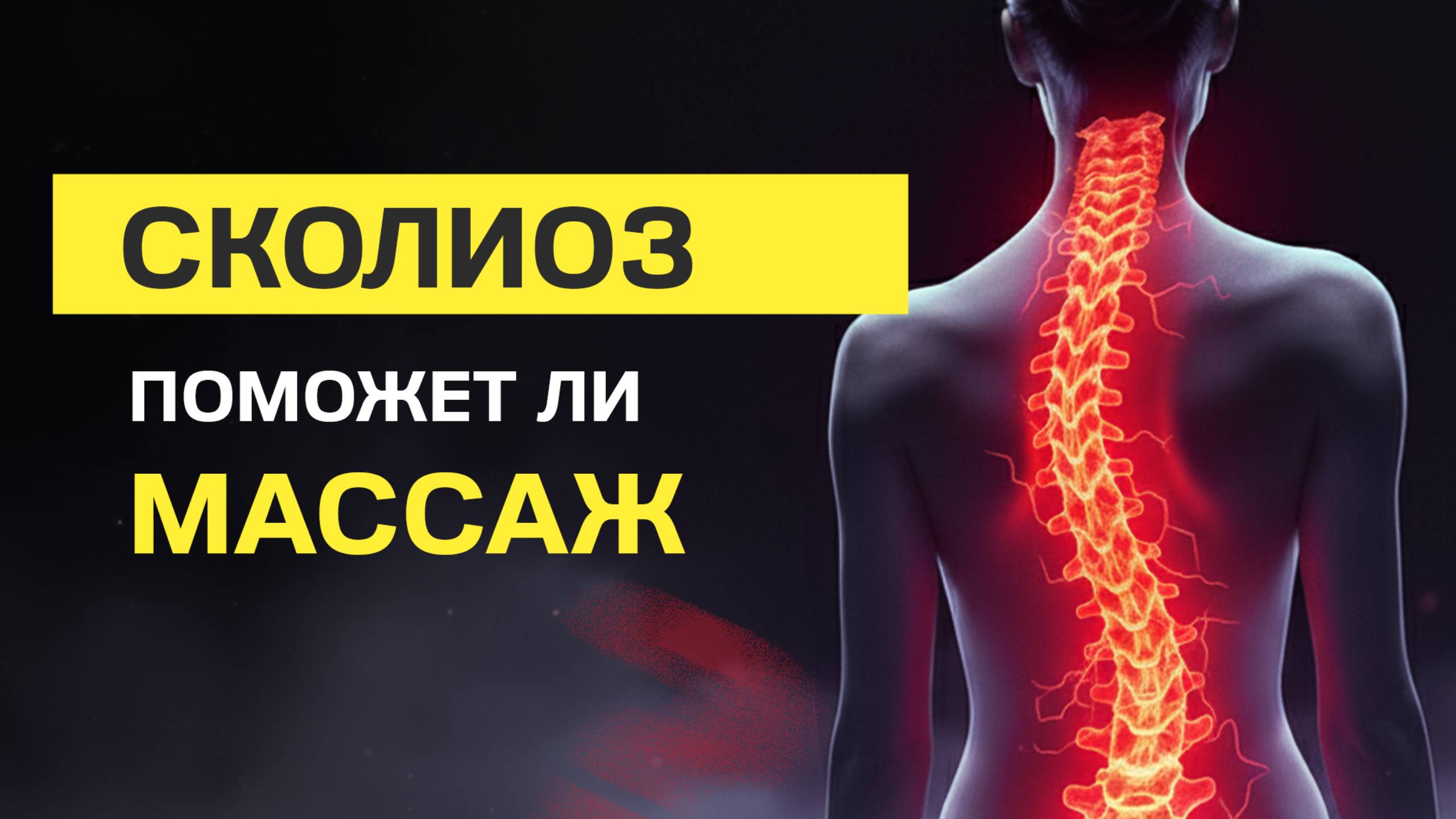 СКОЛИОЗ! ПОМОЖЕТ ЛИ МАССАЖ?