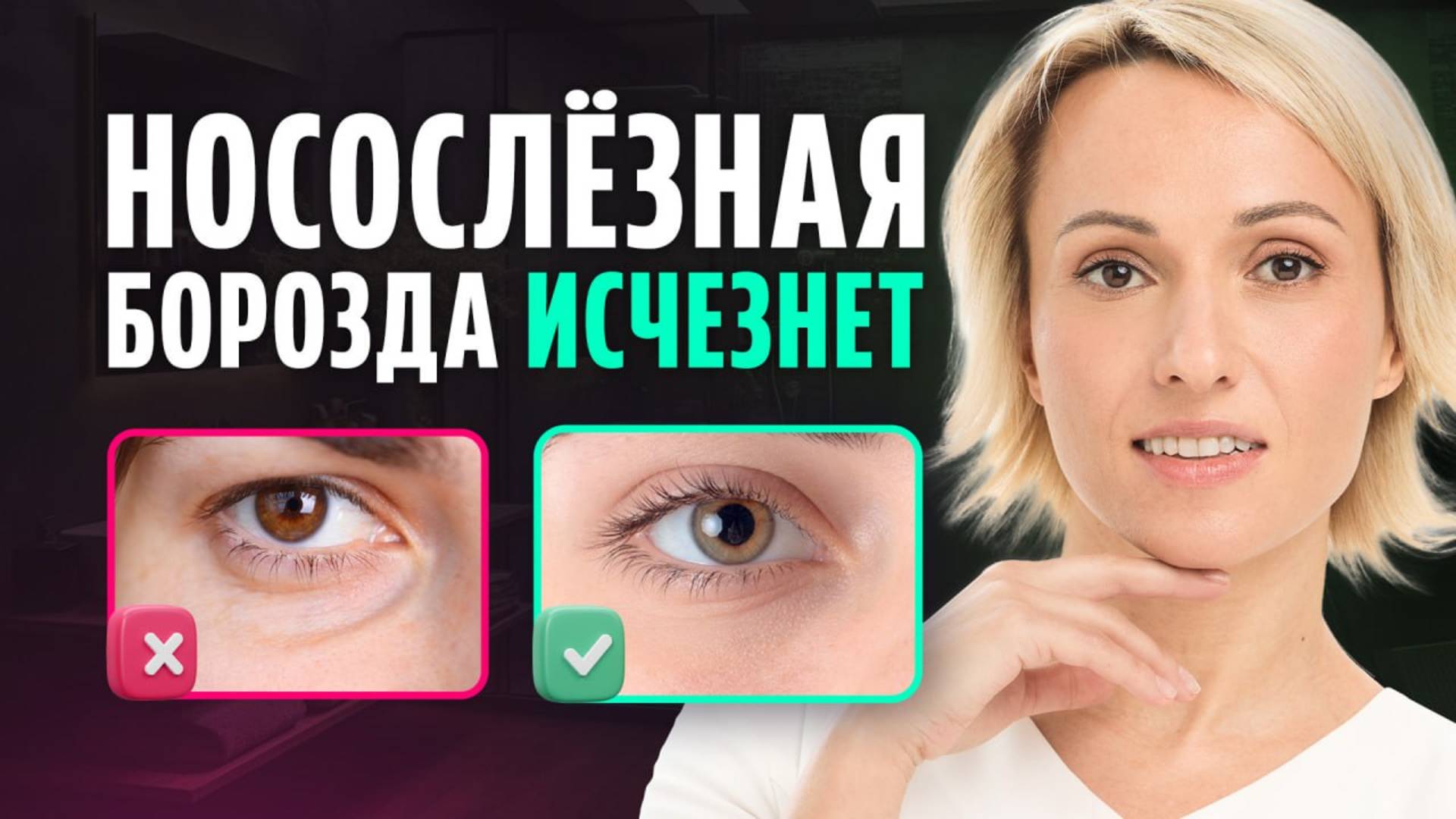 После ЭТИХ приемов НОСОСЛЕЗНАЯ БОРОЗДА исчезнет  Как убрать впадины под глазами без ФИЛЛЕРОВ