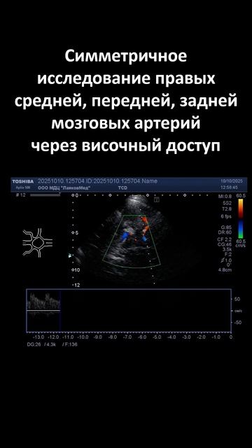 Транскраниальное скнарование артерий основания мозга online-video-cutter.com