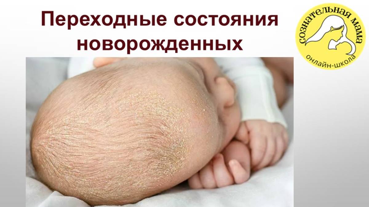 Переходные состояния новорожденных