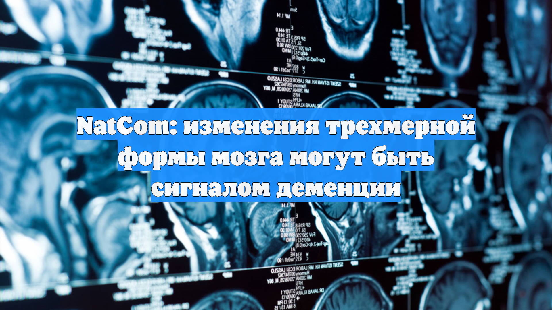 NatCom: изменения трехмерной формы мозга могут быть сигналом деменции