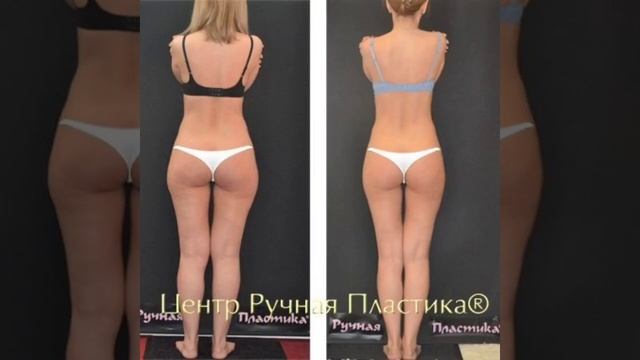 Ручная липосакция. Массаж . Центр  Ручная Пластика®  Волынкина Ю.А .ruchnaya-plastika.ru