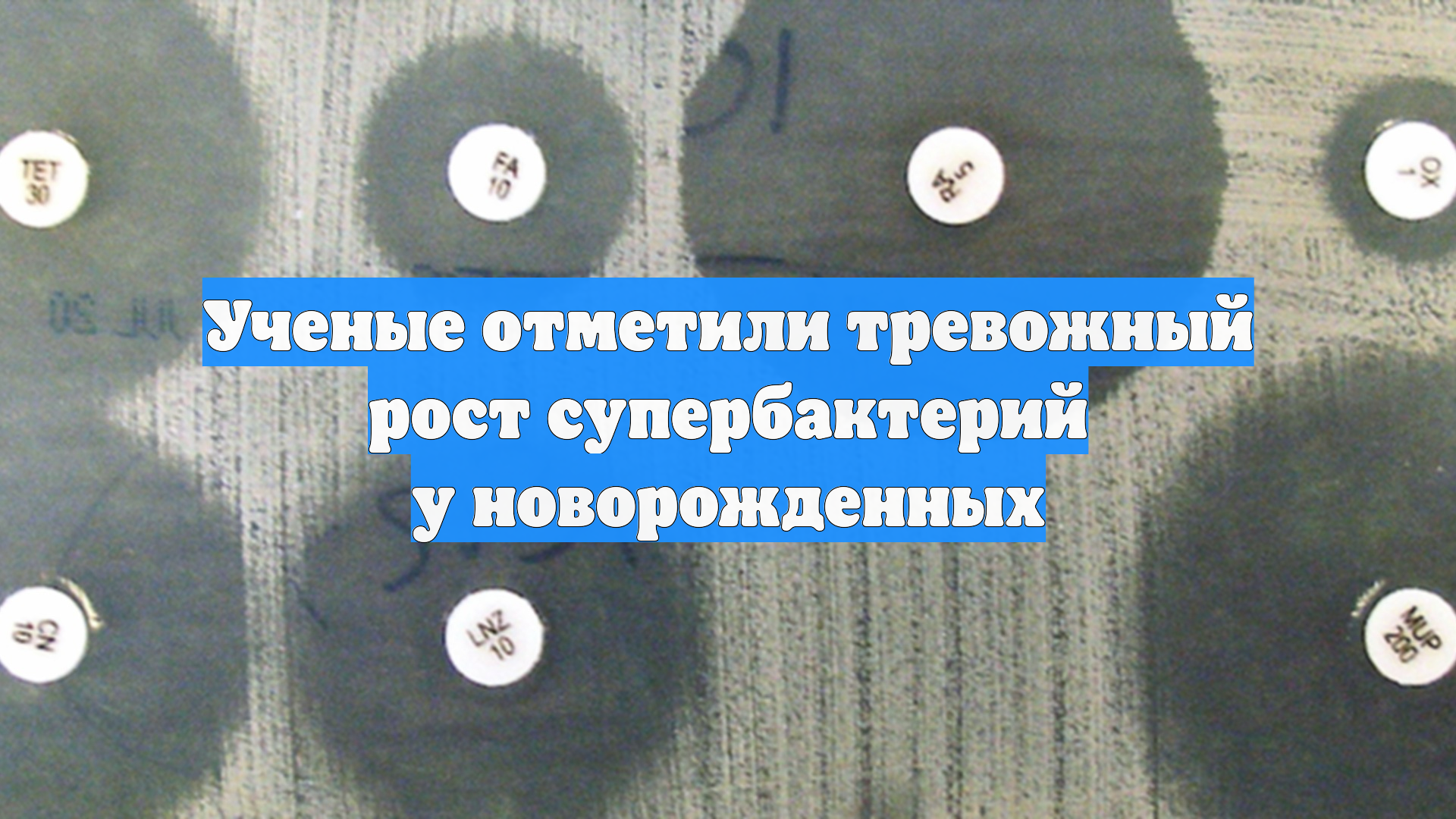 Ученые отметили тревожный рост супербактерий у новорожденных