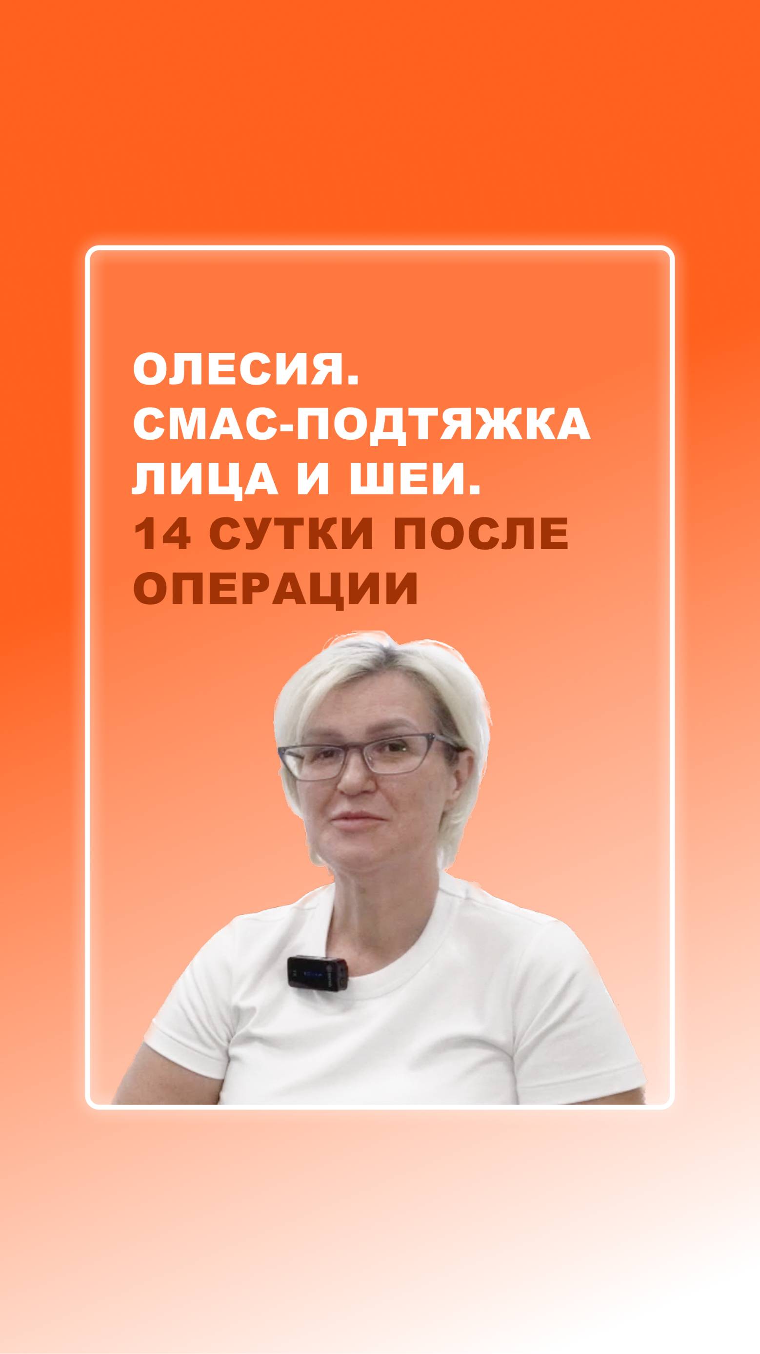 Олесия. Подтяжка лица и шеи. 14 сутки после операции