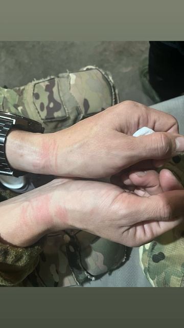 Сколько моей боли в одном фото. Армия России. Следы от наручников.