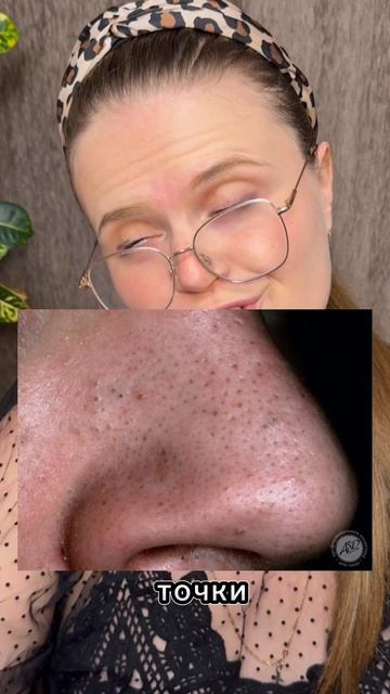 Пилинг от акне и морщин Cosmeya Art WB: #WW123362 #акне #уход #реки #советы #бьюти