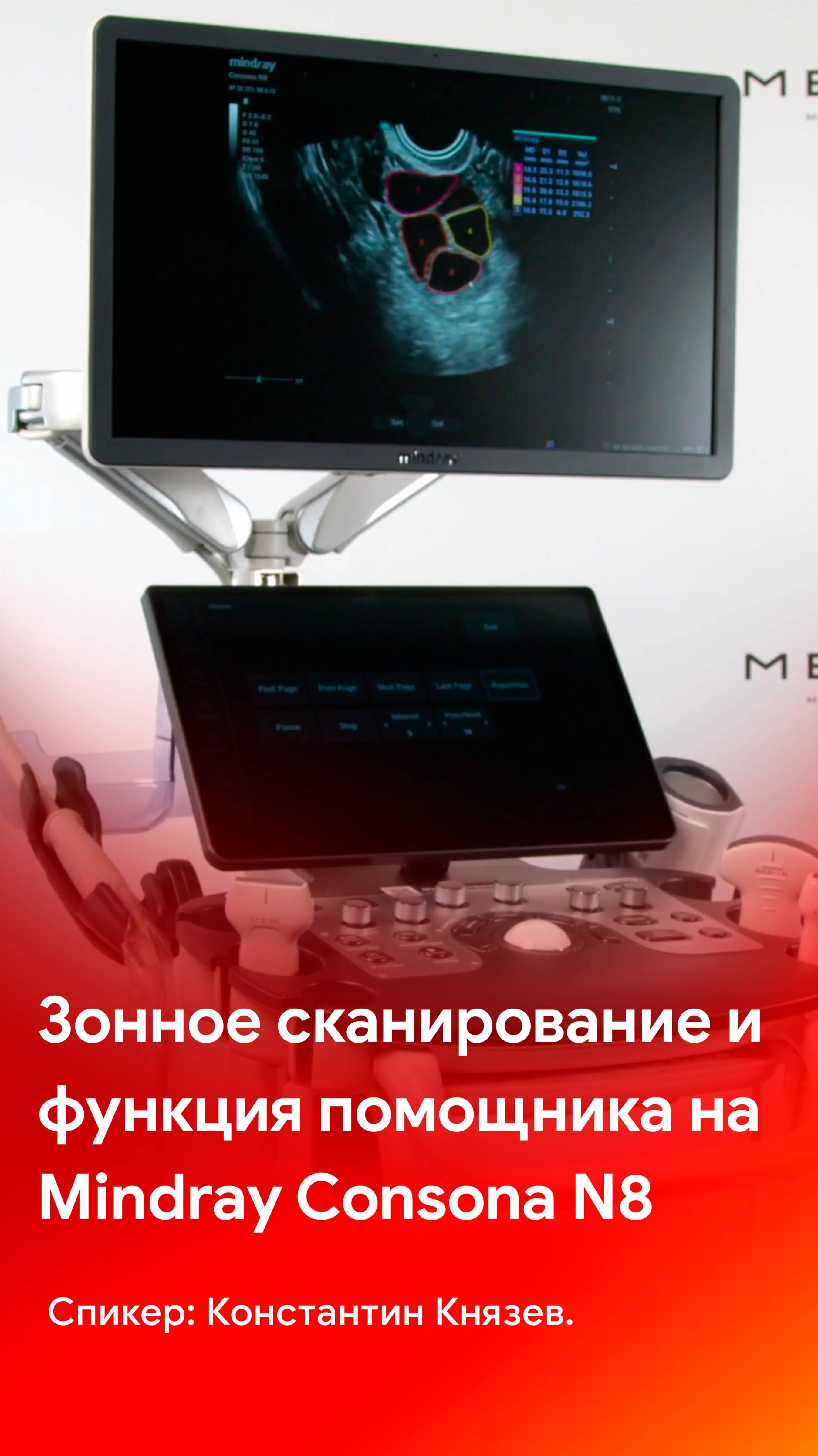 Зонное сканирование и функция помощника на УЗИ аппарате Mindray Consona N8
