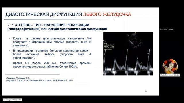 18 ЭхоКГ