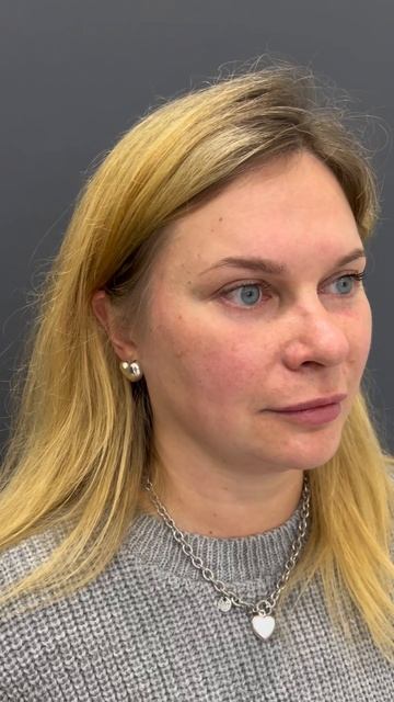 #комплексная_операция: год спустя