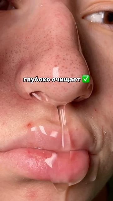 WW152225 - арт гель от черных точек Cosmeya на WB черныеточки акне сальныенити