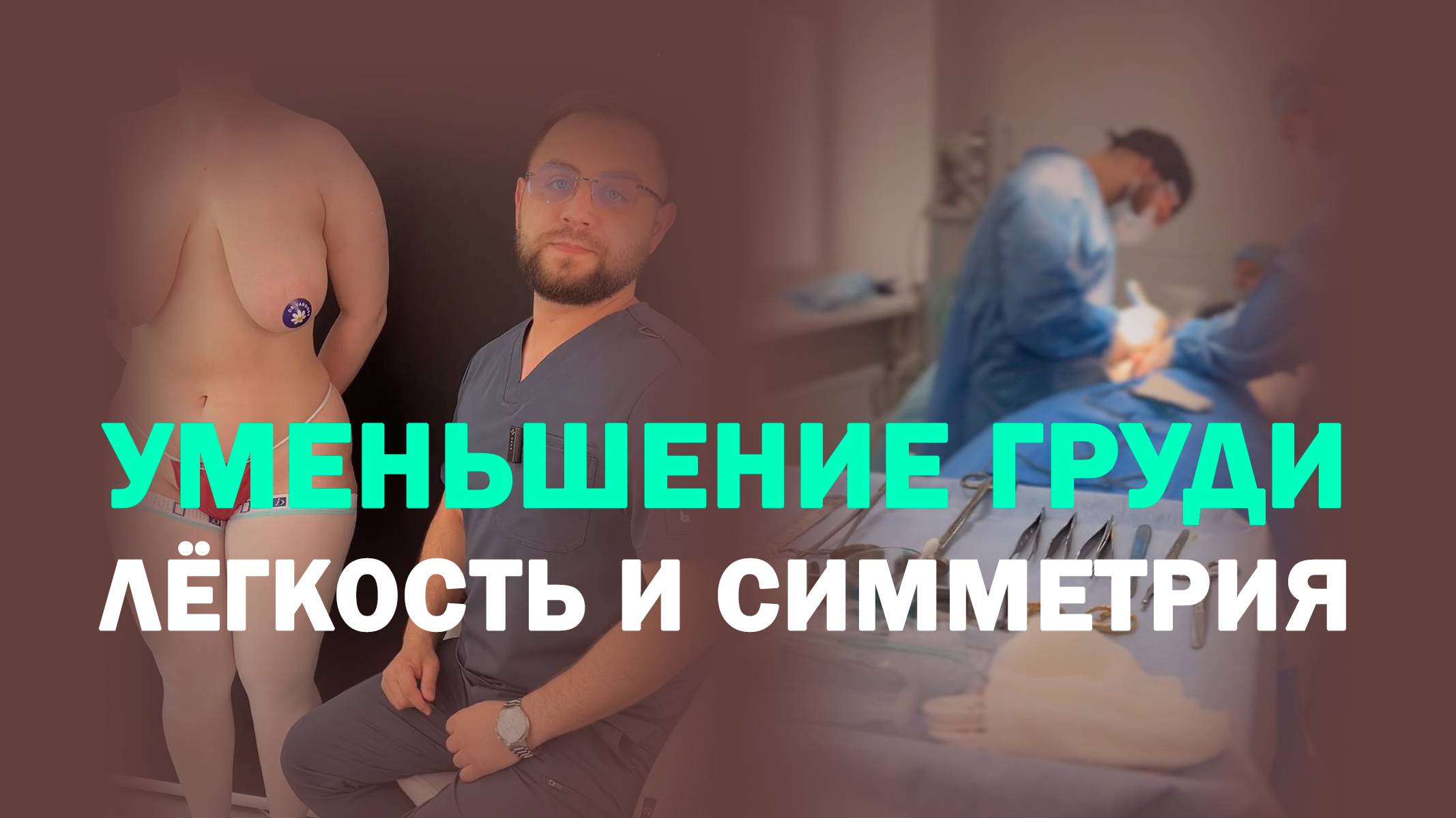 Симметричная и подтянутая грудь после редукции: результат через месяц